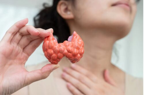 Thyroïde
